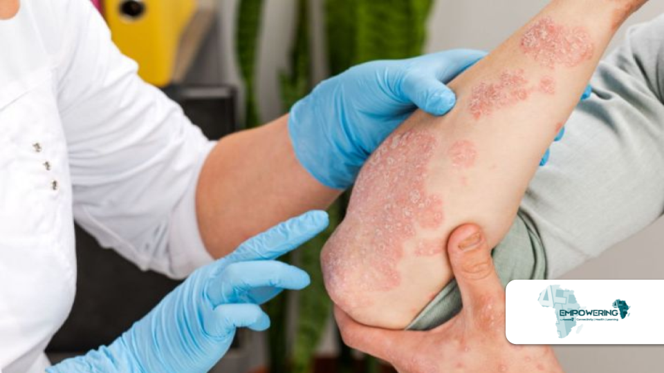 Les maladies de la peau ggd